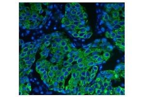 IF analysis of Cytokeratin 8 using anti-Cytokeratin 8 antibody (ABIN6719478). (KRT8 antibody  (AA 107-325))