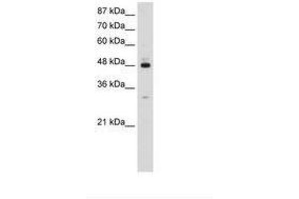 PAIP1 anticorps  (AA 322-371)