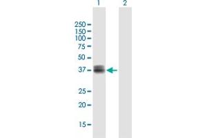 Western Blot analysis of WISP3 expression in transfected 293T cell line by WISP3 MaxPab polyclonal antibody. (WISP3 antibody  (AA 1-372))