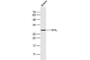 Mouse spleen lysates probed with TIPRL Polyclonal Antibody, Unconjugated  at 1:300 dilution and 4˚C overnight incubation. (TIPRL antibody  (AA 51-150))