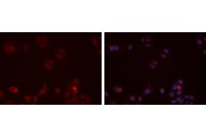 ABIN6273472 staining Hela cells by IF/ICC. (CX3CR1 antibody  (N-Term))
