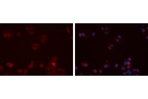 ABIN6273472 staining Hela cells by IF/ICC.