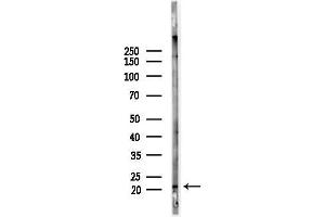 anti-Coiled-Coil-Helix-Coiled-Coil-Helix Domain Containing 4 (CHCHD4) (N-Term) antibody