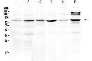 Western blot analysis of HSD17B4 using anti- HSD17B4 antibody . (HSD17B4 antibody  (AA 510-736))