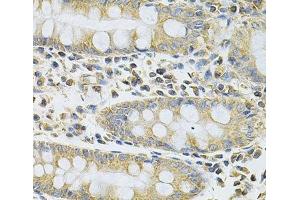 Immunohistochemistry of paraffin-embedded Human colon using SERPINA6 Polyclonal Antibody at dilution of 1:100 (40x lens). (SERPINA6 antibody)