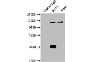 Immunoprecipitating ECT2 in Hela whole cell lysate Lane 1: Rabbit control IgG instead of ABIN7165313 in Hela whole cell lysate.