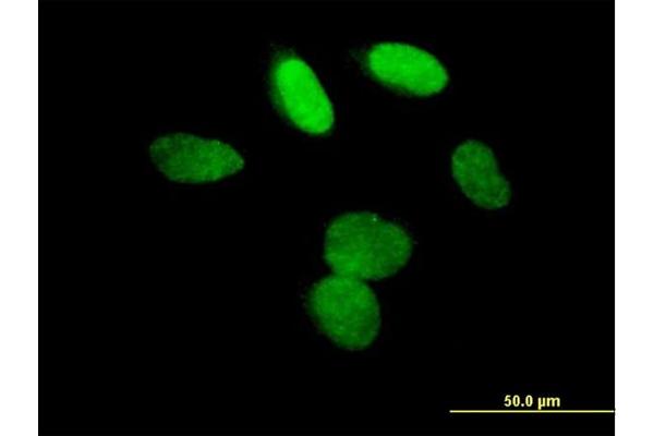 L3MBTL1 antibody  (AA 1-772)