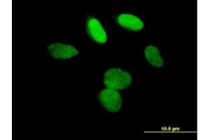 Immunofluorescence of purified MaxPab antibody to L3MBTL on HeLa cell. (L3MBTL1 antibody  (AA 1-772))