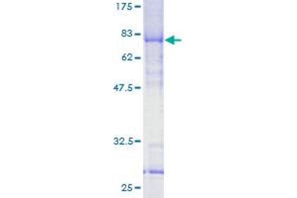 VPS72 Protein (GST tag)