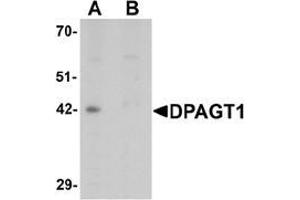 Western blot analysis of DPAGT1 in mouse kidney tissue lysate with DPAGT1 antibody at 1 μg/mL in (A) the absence and (B) the presence of blocking peptide.