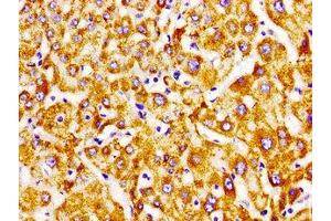 Immunohistochemistry of paraffin-embedded human liver tissue using ABIN7151799 at dilution of 1:100 (PECI/ECI2 antibody  (AA 119-219))