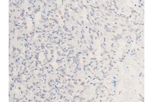 Immunohistochemistry (IHC) image for anti-Checkpoint Kinase 1 (CHEK1) (pSer301) antibody (ABIN6256255)
