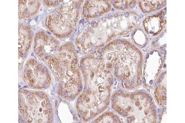 DGKH antibody  (Internal Region)
