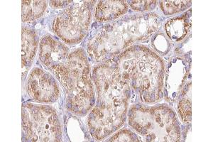 ABIN6266902 at 1/100 staining human kidney tissue sections by IHC-P.