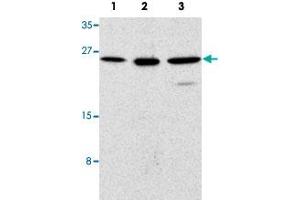 Western blot analysis of human (1), mouse (2), and rat (3) kidney cells with TICAM2 polyclonal antibody  at 1 ug/mL dilution. (TICAM2 antibody  (C-Term))