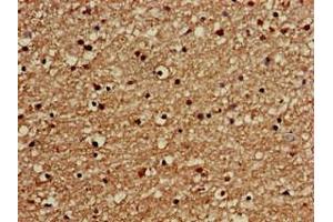 Immunohistochemistry of paraffin-embedded human brain tissue using ABIN7154324 at dilution of 1:100