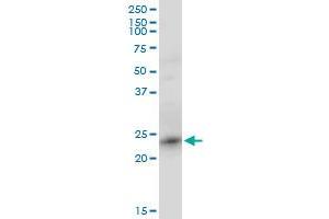RRAS2 monoclonal antibody (M01), clone 2D3-4B8. (RRAS2 antibody  (AA 1-204))