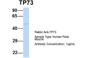 Host:  Rabbit  Target Name:  TP73  Sample Type:  Human Fetal Muscle  Antibody Dilution:  1. (Tumor Protein p73 antibody  (N-Term))
