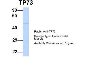 Host:  Rabbit  Target Name:  TP73  Sample Type:  Human Fetal Muscle  Antibody Dilution:  1. (Tumor Protein p73 antibody  (N-Term))