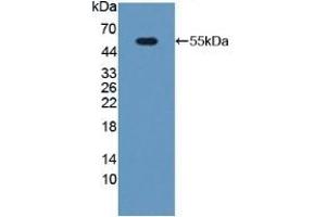 Detection of Recombinant PGP, Mouse using Polyclonal Antibody to Phosphoglycolate Phosphatase (PGP) (PGP antibody  (AA 81-321))