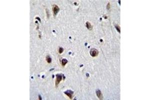 Formalin fixed, paraffin embedded human brain tissue stained with MeCP2 Antibody (N-term) followed by peroxidase conjugation of the secondary antibody and DAB staining.