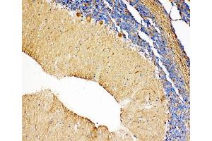 IHC-P: NME2 antibody testing of rat cerebellum tissue (NME2 antibody  (AA 137-152))