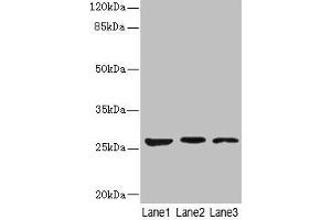 Western blot All lanes: KLK6 antibody at 5 μg/mL Lane 1: Mouse liver tissue Lane 2: Mouse brain tissue Lane 3: A375 whole cell lysate Secondary Goat polyclonal to rabbit IgG at 1/10000 dilution Predicted band size: 27, 16, 5 kDa Observed band size: 27 kDa (Kallikrein 6 antibody  (AA 22-244))