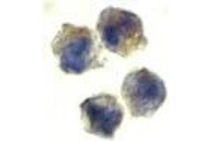 Immunocytochemistry of IL-22 receptor in HepG2 cells with AP30417PU-N IL-22 receptor antibody at 10 μg/ml. (IL22 Receptor alpha 1 antibody  (N-Term))