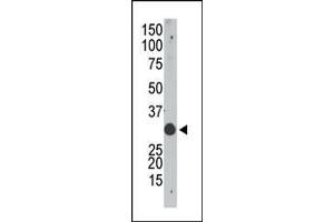 The anti-Apobec1 N-term Pab (ABIN388144 and ABIN2846479) is used in Western blot to detect Apobec in mouse small intestine tissue lysate. (APOBEC1 antibody  (N-Term))