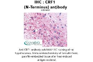 Image no. 2 for anti-Corticotropin Releasing Hormone Receptor 1 (CRHR1) (Extracellular Domain), (N-Term) antibody (ABIN1733304) (CRHR1 antibody  (Extracellular Domain, N-Term))