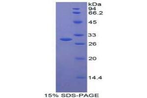 SDS-PAGE analysis of Human CNTFR Protein. (CNTF Receptor alpha Protein)