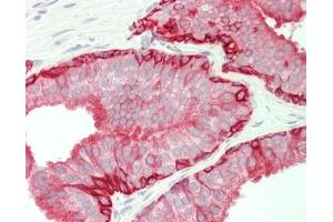 Human Prostate: Formalin-Fixed, Paraffin-Embedded (FFPE) (Cytokeratin 5 antibody  (AA 1-273))