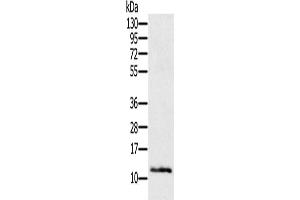 Gel: 12 % SDS-PAGE, Lysate: 40 μg, Lane: Mouse skin tissue, Primary antibody: ABIN7193125(Ly6a Antibody) at dilution 1/200, Secondary antibody: Goat anti rabbit IgG at 1/8000 dilution, Exposure time: 2 minutes (Sca-1/Ly-6A/E antibody)