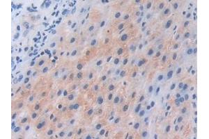 Immunohistochemistry (IHC) image for anti-Phosphoinositide-3-Kinase, Catalytic, beta Polypeptide (PIK3CB) (AA 807-1070) antibody (ABIN7437749)