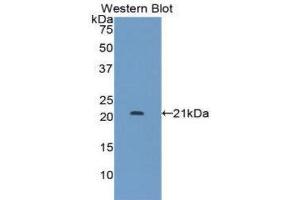 Western Blotting (WB) image for anti-Leukemia Inhibitory Factor Receptor alpha (LIFR) (AA 522-691) antibody (ABIN1859660) (LIFR antibody  (AA 522-691))