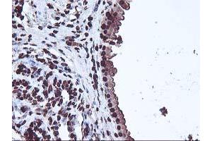 Immunohistochemical staining of paraffin-embedded Human breast tissue using anti-OSGEP mouse monoclonal antibody. (OSGEP antibody  (AA 1-335))