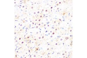 Immunohistochemistry of paraffin-embedded rat ovary using DP1/TFDP1 Rabbit mAb (ABIN7270891) at dilution of 1:100 (40x lens). (DP1 antibody)