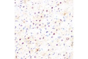 Immunohistochemistry of paraffin-embedded rat ovary using DP1/TFDP1 Rabbit mAb (ABIN7270891) at dilution of 1:100 (40x lens). (DP1 antibody)