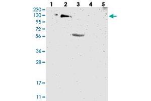 Western blot analysis of Lane 1: RT-4, Lane 2: U-251 MG, Lane 3: Human Plasma, Lane 4: Liver, Lane 5: Tonsil with USP36 polyclonal antibody  at 1:250-1:500 dilution.