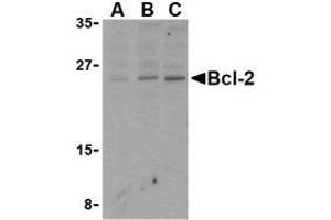 Western blot analysis of Bcl-2 in Daudi cell lysates with AP30128PU-N Bcl-2 antibody at (A) 1, (B) 2, and (C) 4 μg/ml.