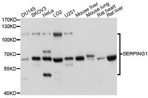 Western blot analysis of extracts of various cell lines, using SERPING1 antibody. (SERPING1 antibody  (AA 201-500))