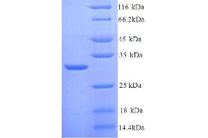 SDS-PAGE (SDS) image for Kininogen 1 (KNG1) (AA 390-639), (full length) protein (His tag) (ABIN7479070)