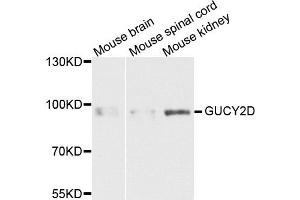 Western blot analysis of extracts of various cells, using GUCY2D antibody. (GUCY2D antibody)
