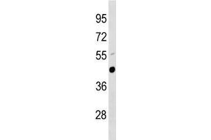 Urokinase antibody western blot analysis in mouse lung tissue lysate. (PLAU antibody  (AA 304-331))