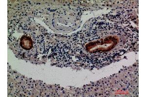 Immunohistochemical analysis of paraffin-embedded human-liver, antibody was diluted at 1:200 (F13B antibody  (Internal Region))