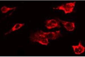 ABIN6267635 staining Hela by IF/ICC. (GRIN2B antibody  (pTyr1336))