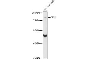 Western blot analysis of extracts of various cell lines, using CTCFL antibody (ABIN6131039, ABIN6139183, ABIN6139185 and ABIN6221755) at 1:1000 dilution. (CTCFL antibody  (AA 1-270))