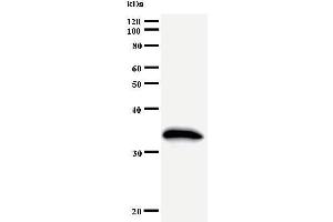 Western Blotting (WB) image for anti-General Transcription Factor IIH, Polypeptide 2, 44kDa (GTF2H2) antibody (ABIN930961) (GTF2H2 antibody)