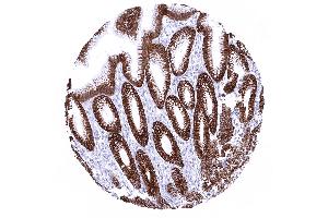 Immunohistochemistry (IHC) image for anti-Keratin 18 (KRT18) antibody (ABIN7477447)
