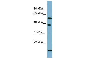 WB Suggested Anti-SLC10A1 Antibody Titration:  0.